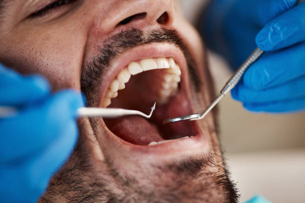 Best Emergency Broken Tooth Repair in Prospect Rk, PA